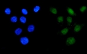 Immunofluorescent staining of FFPE human SK-O-V3 cells with Apoptosis inhibitor 5 antibody (green) and DAPI nuclear stain (blue). HIER: steam section in pH6 citrate buffer for 20 min.