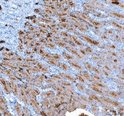 IHC-P: AQP1 antibody testing of human kidney cancer tissue