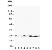 Western blot testing of Bax antibody and Lane 1:  rat testis;  2: rat kidney;  3: (r) brain;  4: (r) ovary;  5: human HeLa;  6: (h) MM231;  7: (h) A549;  8: (h) Jurkat;  9: (h) placenta tissue lysate. Predicted molecular weight: 21-24 kDa.
