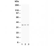 Western blot testing of BDNF antibody and Lane 1:  rat brain;  2: mouse brain;  3: MCF-7;  Predicted size: 28KD;  Observed size: 37KD