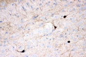 IHC staining of FFPE rat brain tissue with Calretinin antibody. HIER: boil tissue sections in pH8 EDTA for 20 min and allow to cool before testing.