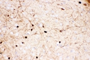IHC staining of FFPE mouse brain tissue with Calretinin antibody. HIER: boil tissue sections in pH8 EDTA for 20 min and allow to cool before testing.