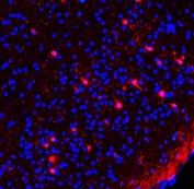 Immunofluorescent staining of FFPE mouse brain tissue with Calretinin antibody (red) and DAPI nuclear stain (blue). HIER: steam section in pH6 citrate buffer for 20 min.