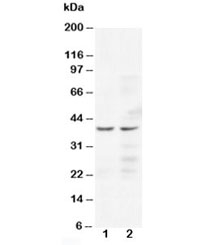 Western blot testing of CCR5 antibody and human Lane 1: Jurkat; 2: COLO320 cell lysate. Predicted/observed molecular weight ~41 kDa.~