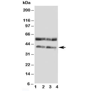 Western blot testing of CCR5 antibody and Lane 1: COLO320; 2: MCF-7; 3: SMMC-7721; 4: Jurkat cell lysate