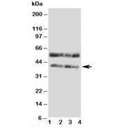 Western blot testing of CCR5 antibody and Lane 1:  COLO320;  2: MCF-7;  3: SMMC-7721;  4: Jurkat cell lysate. Predicted molecular weight ~41 kDa.