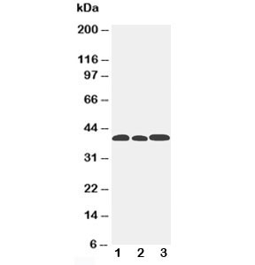 Western blot testing of CCR5 antibody and Lane 1: mouse lung; 2: mouse intestine; 3: mouse kidney