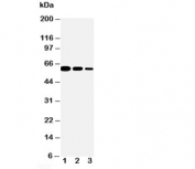 Western blot testing of CD40 antibody and Lane 1:  Recombinant mouse protein 10ng;  2: 5ng;  3: 2.5ng