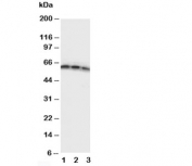 Western blot testing of CD40 antibody and Lane 1:  Recombinant human protein 10ng;  2: 5ng;  3: 2.5ng
