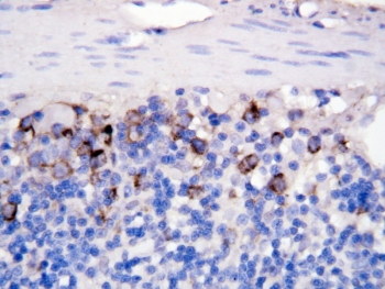 IHC-P: CD40L antibody testing of rat intestine tissue