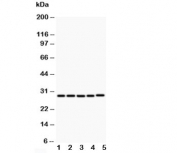 Western blot testing of CD40L antibody and Lane 1:  MCF-7;  2: HeLa;  3: Jurkat;  4: HMY2;  5: COLO320;  Expected molecular weight: 29-39 kDa (depending on glycosylation level) or ~18 kDa (soluble form).