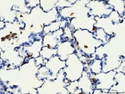 IHC staining of FFPE rat lung tissue with CD44 antibody. HIER: boil tissue sections in pH8 EDTA for 20 min and allow to cool before testing.
