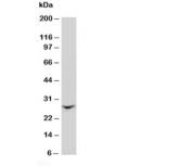 Western blot testing of GJB2 antibody and rat liver tissue lysate. Predicted molecular weight: ~26kDa.