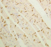 IHC staining of FFPE rat heart tissue with Connexin 43 antibody at 1ug/ml. HIER: boil tissue sections in pH6, 10mM citrate buffer, for 10-20 min and allow to cool before testing.