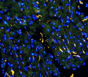 Immunofluorescent staining of FFPE rat heart tissue with Connexin 43 antibody (green) at 1ug/ml and DAPI nuclear stain. HIER: boil tissue sections in pH6, 10mM citrate buffer, for 10-20 min and allow to cool before testing.