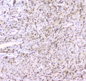 IHC testing of rat heart tissue with Cx43 antibody at 1ug/ml. HIER: steam section in pH6 citrate buffer for 20 min and allow to cool prior to staining.