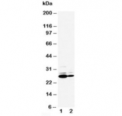 Western blot testing of C Reactive protein antibody and Lane 1:  SMMC-7721;  2: HT1080 cell lysate. Predicted molecular weight ~26 kDa.