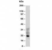 Western blot testing of FGF4 antibody and human HeLa cell lysate. Predicted molecular weight ~22 kDa.