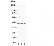 Western blot testing of GAP43 antibody and Lane 1:  U87;  2: rat brain;  3: mouse brain;  Predicted/observed molecular weight: ~43kDa.