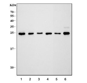 Western blot testing of 1) human HeLa, 2) human 293T, 3) human Jurkat, 4) rat lung 5) mouse lung and 6) mouse liver tissue lysate with GST pi antibody. Predicted molecular weight ~23 kDa.