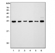 Western blot testing of 1) human HeLa, 2) human 293T, 3) human Jurkat, 4) rat lung 5) mouse lung and 6) mouse liver tissue lysate with GST pi antibody. Predicted molecular weight ~23 kDa.
