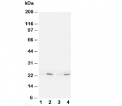 Western blot testing of HMGB4 antibody and Lane 1:  rat brain;  2: rat testis;  3: (h) Jurkat;  4: (h) HT1080 cell lysate