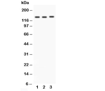 Western blot testing of Integrin alpha 1 antibody and Lane 1: rat brain; 2: HeLa; 3: SW620; Predicted size: 131KD; Observed size: 131KD