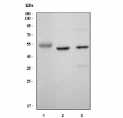 Western blot testing of 1) human placenta, 2) rat brain and 3) mouse brain tissue lysate with KCNN4 antibody. Predicted molecular weight ~48 kDa.
