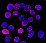 Immunofluorescent staining of FFPE human SiHa cells with Lamin B1 antibody (red) and DAPI nuclear stain (blue). HIER: steam section in pH6 citrate buffer for 20 min.