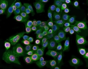 Immunofluorescent staining of FFPE human SiHa cells with Lamin B1 antibody (red) and Beta Tubulin antibody (green). HIER: steam section in pH6 citrate buffer for 20 min.
