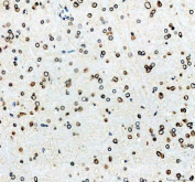 Immunocytochemical staining of FFPE human A549 cells with Lamin B1 antibody. HIER: boil tissue sections in pH6 citrate buffer for 20 min and allow to cool before testing.