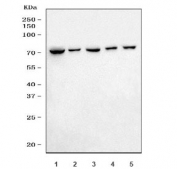 Western blot testing of 1) human Daudi, 2) human ThP-1, 3) human HL-60, 4) rat lung and 5) mouse lung tissue lysate with Lamin B1 antibody. Predicted molecular weight ~66 kDa.