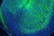 Immunofluorescent staining of FFPE mouse brain with MBP antibody (green) at 2ug/ml and DAPI nuclear stain (blue). HIER: steam section in pH6 citrate buffer for 20 min.