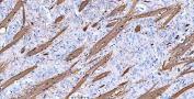 IHC-P: MBP antibody testing of rat brain tissue. HIER: boil tissue sections in pH8 EDTA buffer for 10-20 min and allow to cool before testing.