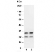 Western blot testing of MBP antibody and mouse brain tissue lysate. Multiple isoforms may be visualized from 20~37 kDa.