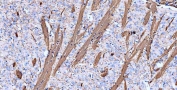 IHC-P: MBP antibody testing of mouse brain tissue. HIER: boil tissue sections in pH8 EDTA buffer for 10-20 min and allow to cool before testing.