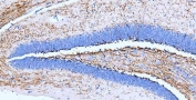 IHC-P: MBP antibody testing of rat hippocampus tissue. HIER: boil tissue sections in pH8 EDTA buffer for 10-20 min and allow to cool before testing.