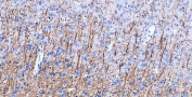 IHC-P: MBP antibody testing of rat cerebral cortex tissue. HIER: boil tissue sections in pH8 EDTA buffer for 10-20 min and allow to cool before testing.