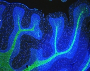 Immunofluorescent staining of FFPE rat brain with MBP antibody (green) at 2ug/ml and DAPI nuclear stain (blue). HIER: steam section in pH6 citrate buffer for 20 min.