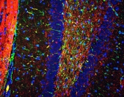 Immunofluorescent staining of FFPE rat brain with MBP antibody (red), anti-GFAP mAb (green) and DAPI nuclear stain (blue). HIER: steam section in pH6 citrate buffer for 20 min.