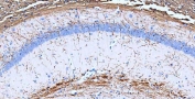 IHC-P: MBP antibody testing of mouse hippocampus tissue. HIER: boil tissue sections in pH8 EDTA buffer for 10-20 min and allow to cool before testing.