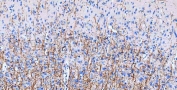 IHC-P: MBP antibody testing of mouse cerebral cortex tissue. HIER: boil tissue sections in pH8 EDTA buffer for 10-20 min and allow to cool before testing.