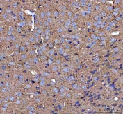 IHC staining of FFPE mouse brain tissue with MIF antibody. HIER: boil tissue sections in pH8 EDTA buffer for 20 min and allow to cool before testing.