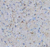 IHC staining of FFPE rat brain tissue with MIF antibody. HIER: boil tissue sections in pH8 EDTA buffer for 20 min and allow to cool before testing.