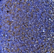IHC staining of FFPE rat lymph tissue with Myeloperoxidase antibody. HIER: boil tissue sections in pH8 EDTA for 20 min and allow to cool before testing.