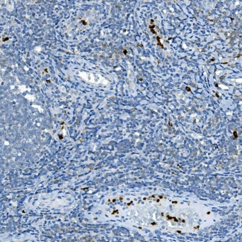 IHC staining of FFPE human tonsil tissue with Myeloperoxidase antibody. HIER: boil tissue sections in pH8 EDTA for 20 min and allow to cool before testing.