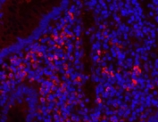 Immunofluorescent staining of FFPE human appendicitis tissue with Myeloperoxidase antibody (red) and DAPI nuclear stain (blue). HIER: steam section in pH8 EDTA buffer for 20 min.