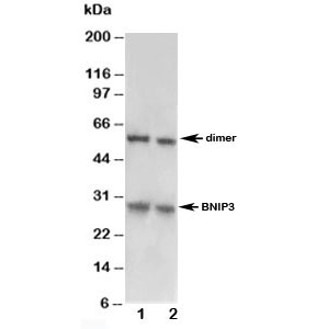 Western blot testing of BNIP3 antibody and Lane 1: HeLa; 2: MM231
