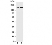 Western blot testing of NMDAR2B antibody and Lane 1:  rat brain;  2: mouse brain. Predicted molecular weight ~166kDa.