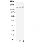 Western blot testing of NMDAR2B antibody and Lane 1:  rat brain;  2: mouse brain;  3: human U87 cell lysate. Predicted molecular weight ~166kDa.